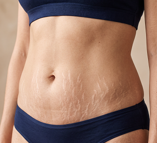 Barku zona abdominale