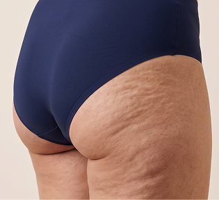 Zona gluteale
